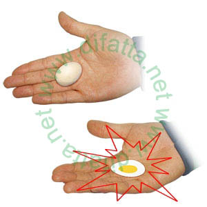 (image for) Crushed Egg Gag